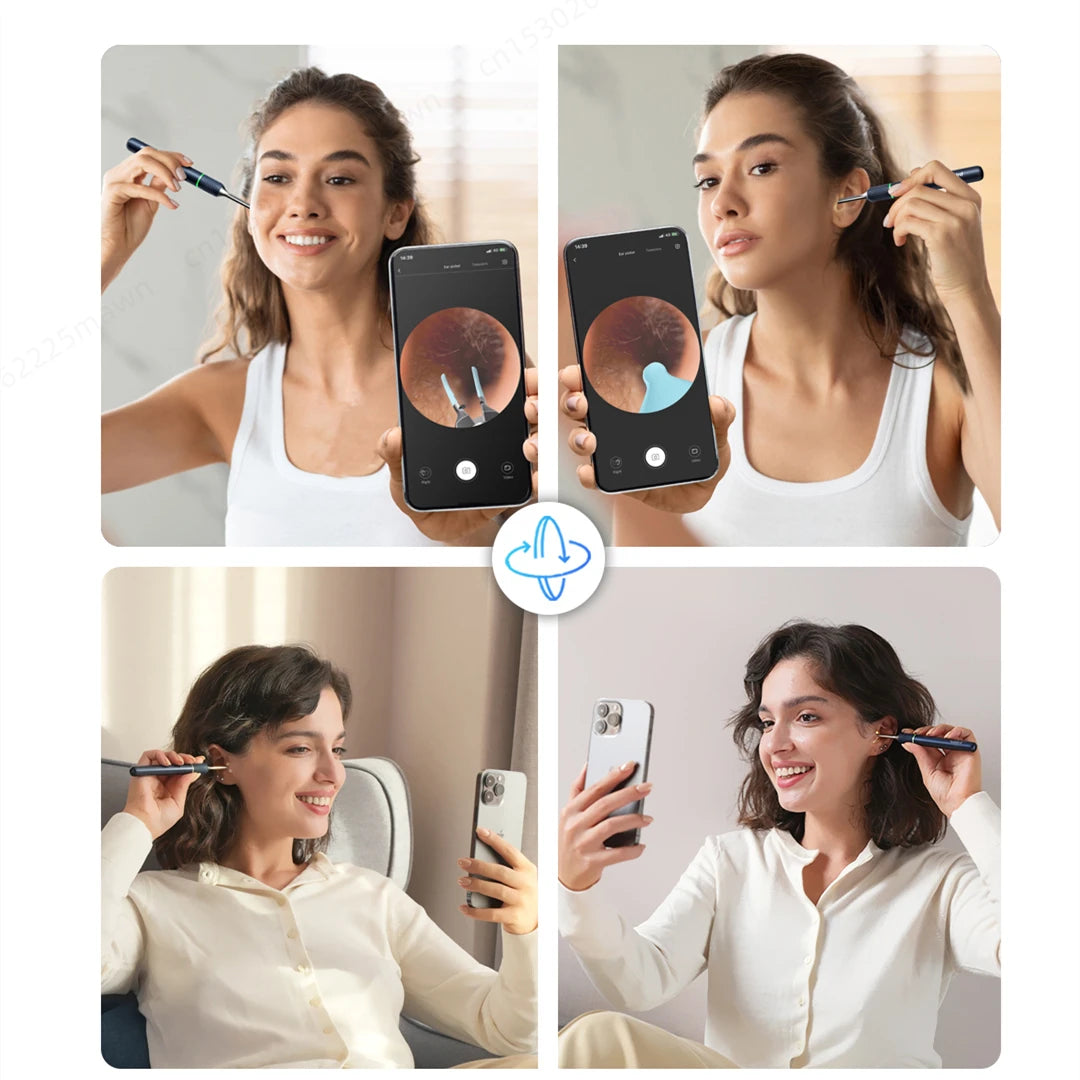 Smart Visual Ear Cleaner with Mini Camera - Note5 Pro Endoscope Tweezers for Personal Health Care