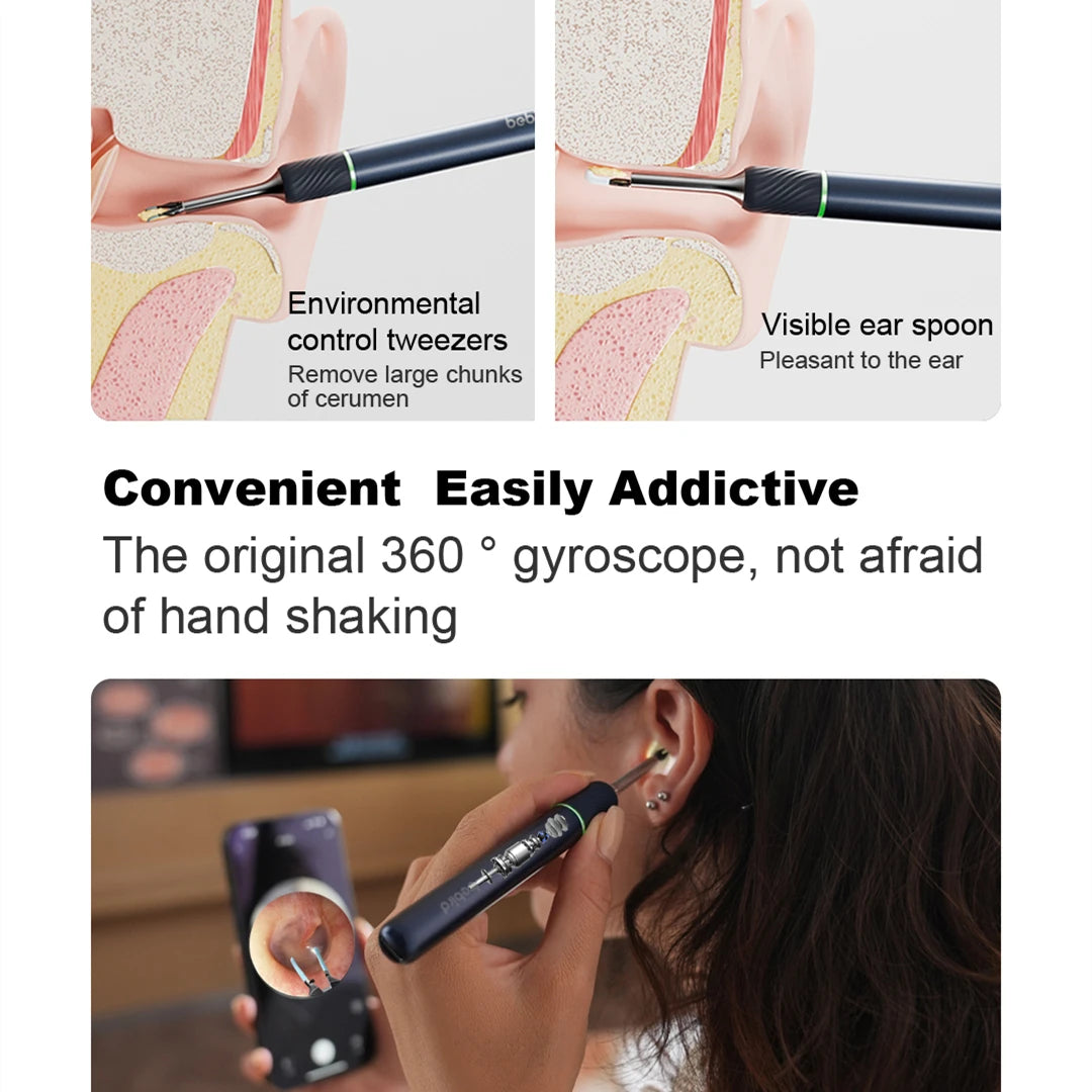 Smart Visual Ear Cleaner with Mini Camera - Note5 Pro Endoscope Tweezers for Personal Health Care