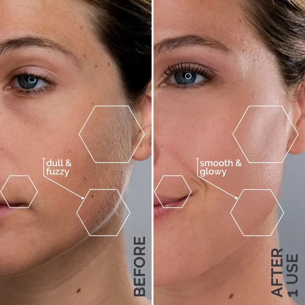Sonicsmooth Pro+: Ultimate At-Home Dermaplaning Tool for Radiant Skin